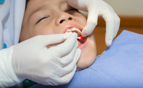 Nær halvparten av dagens 20-åringer har hatt tannregulering
